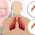 بیماری انسداد مجاری تنفسی مزمن یا COPD چیست؟